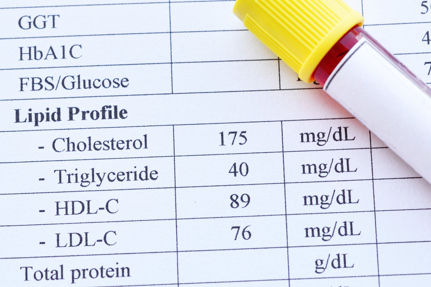 PCOS/PMOS and Cholesterol: Why Lipid Screening Matters at Any BMI